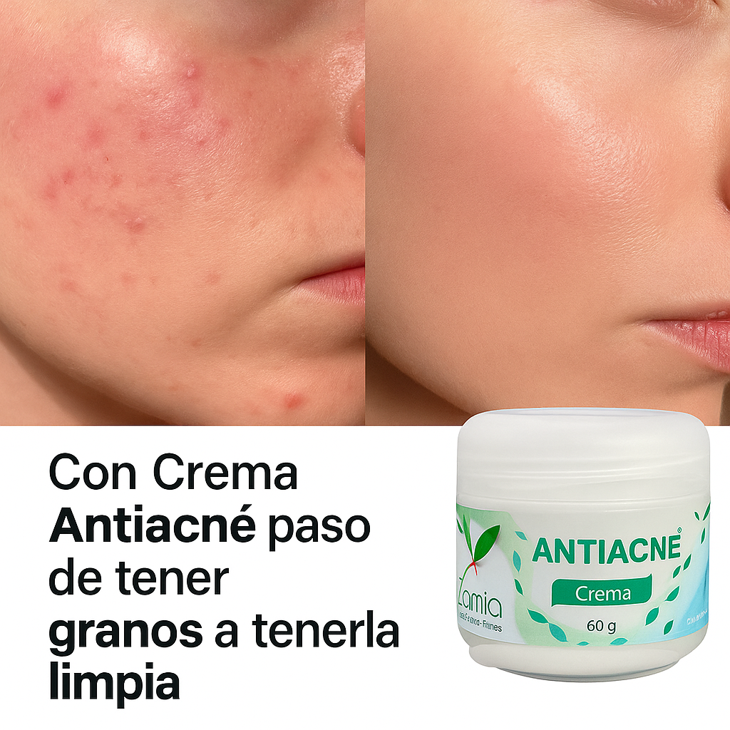 COMBO ACLARANTE + ANTIACNÉ